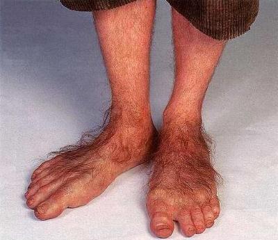 On dirait des pieds de hobbit !